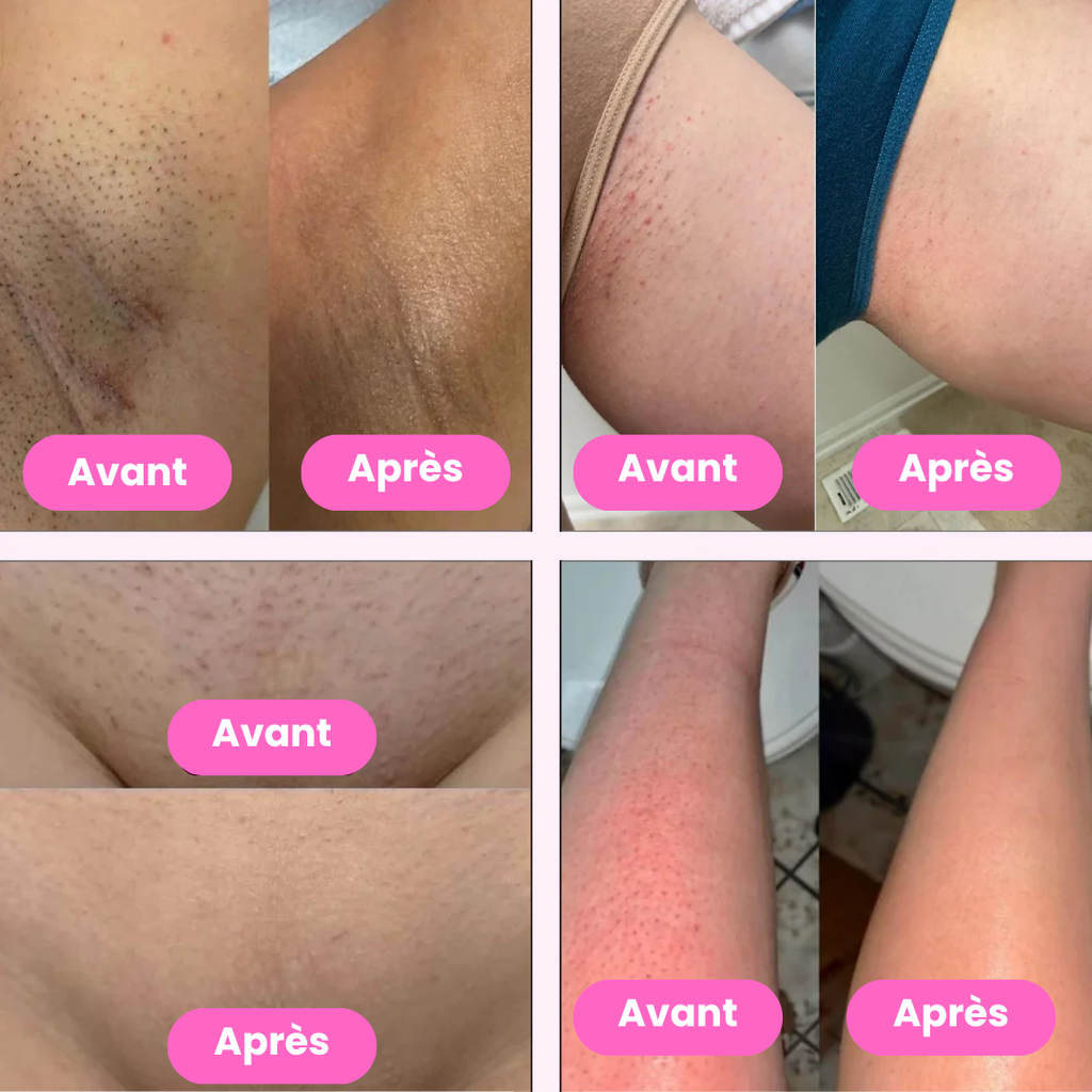 Exemples de zones du visage et du corps pouvant être rasées avec le rasoir électrique Nusika
